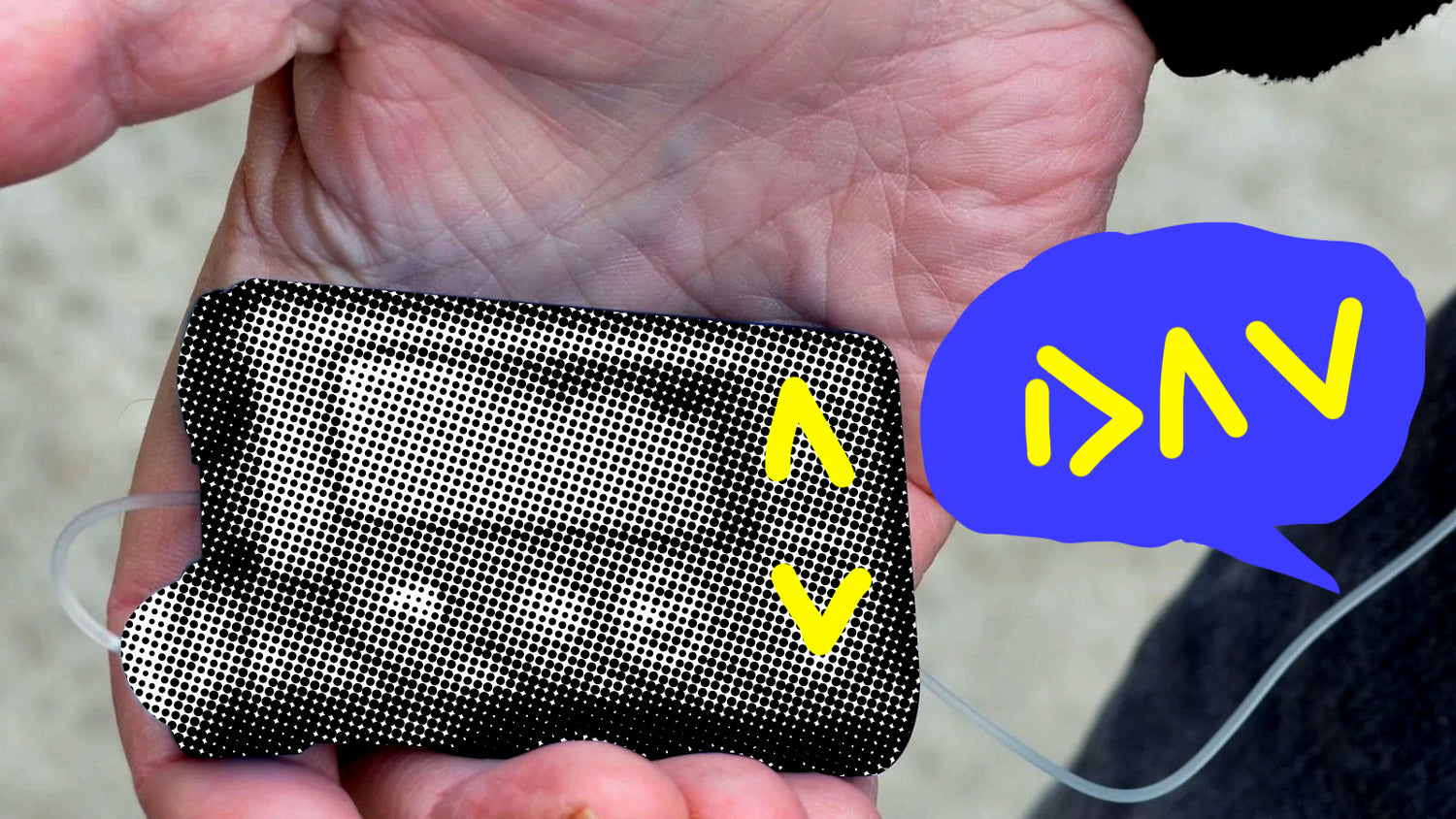 what-does-dav-stand-for-in-the-diabetes-community-the-diabetic-survivor