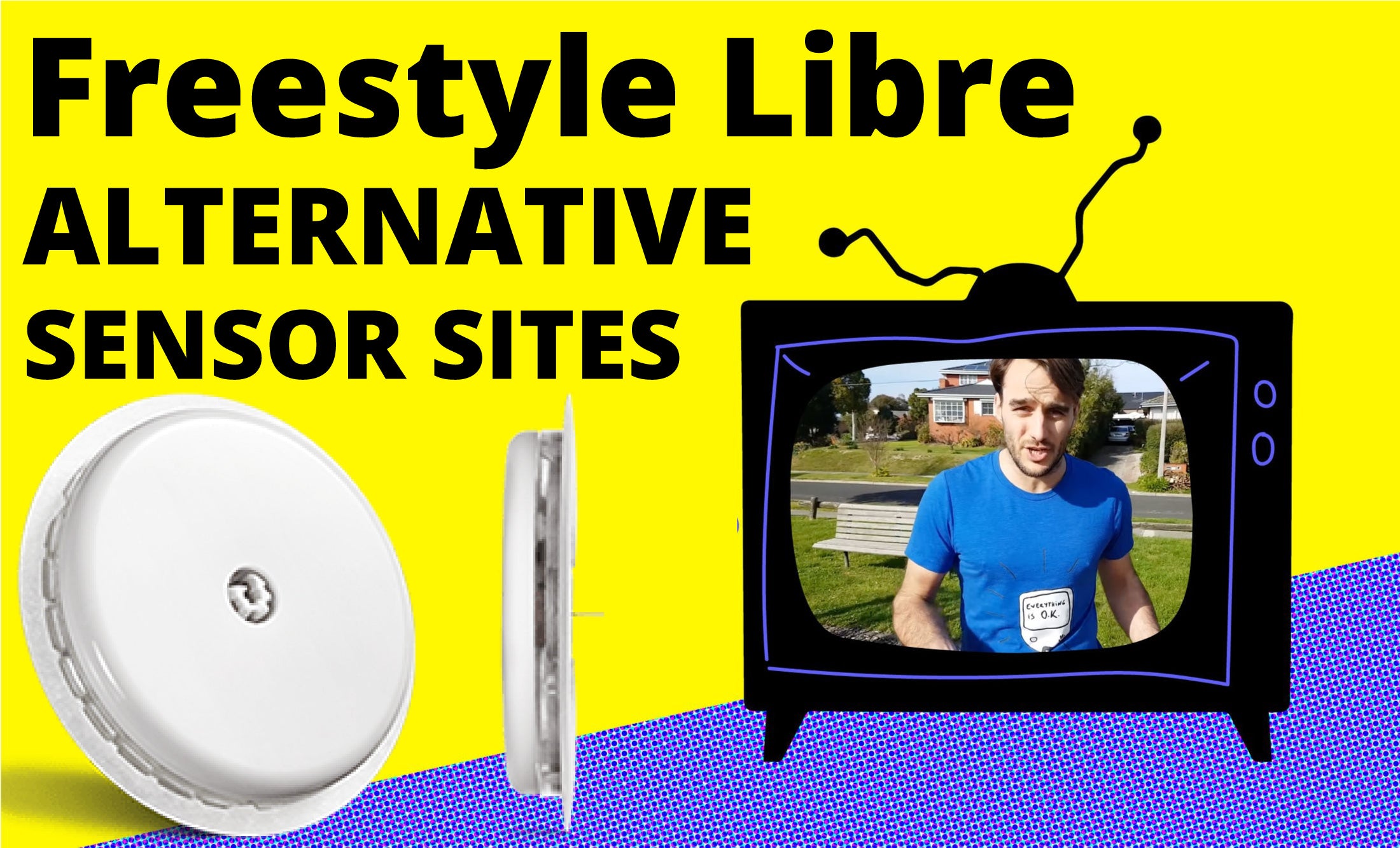 Freestyle Libre Alternative Sensor Sites – The Diabetic Survivor